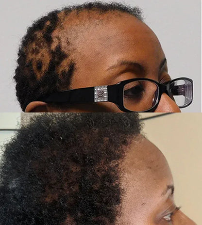 Hair Growth Roll-On Serum