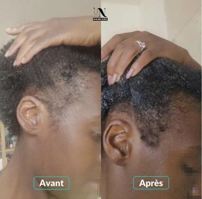Hair Growth Roll-On Serum