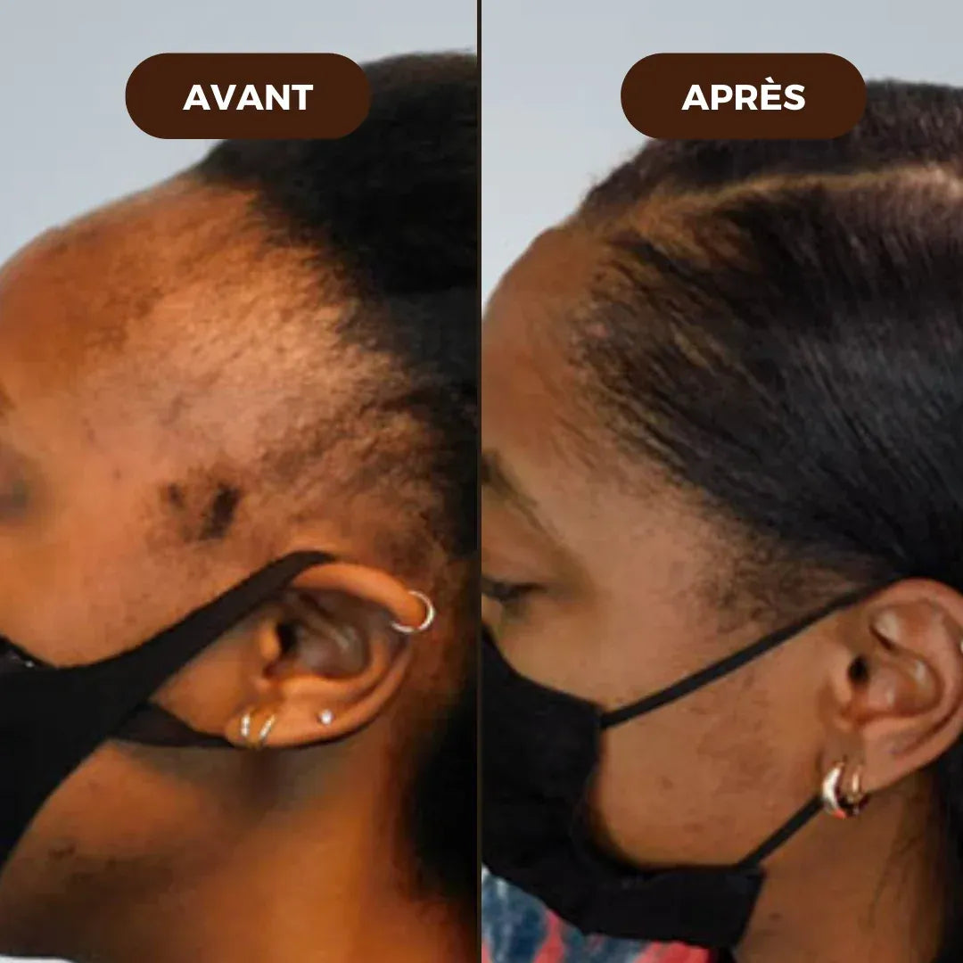 Hair Growth Roll-On Serum